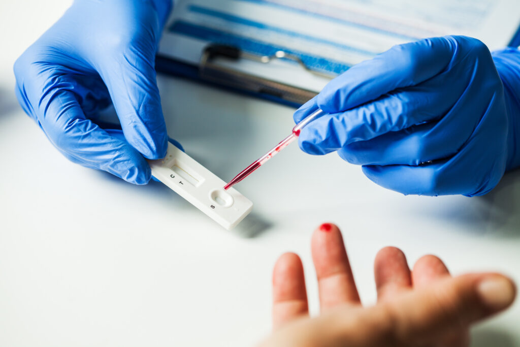 Lateral Flow Tests: A Diagnostic Revolution